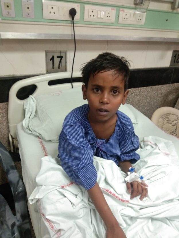 Arbaj After Surgery